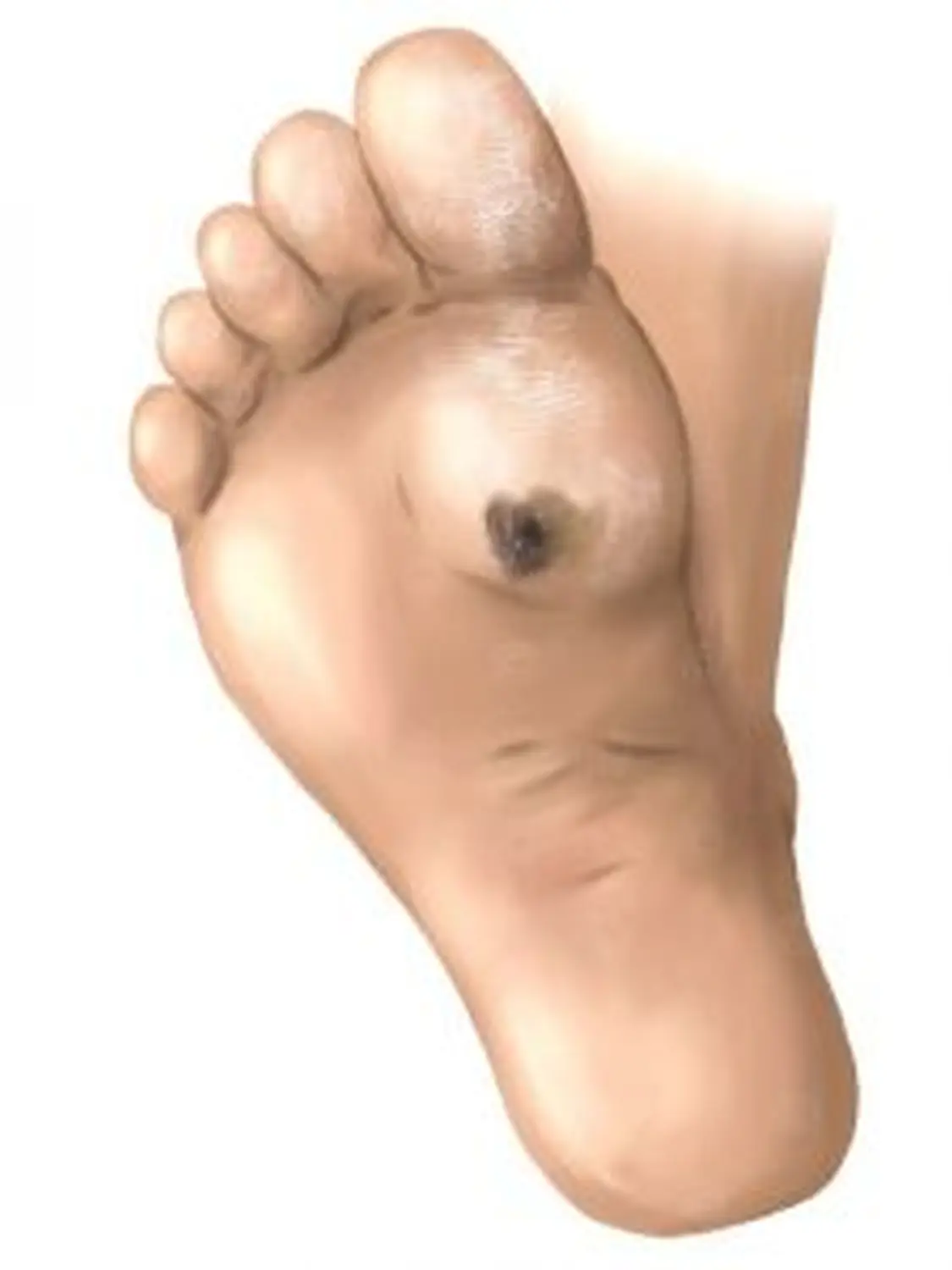 AgoCare UG - Gesundheitsdienstleister - Diabetischer Fußsyndrom von AgoCare UG (Haftungsbeschränkt)